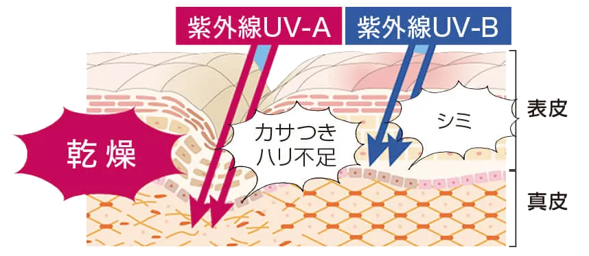 UV-A,B